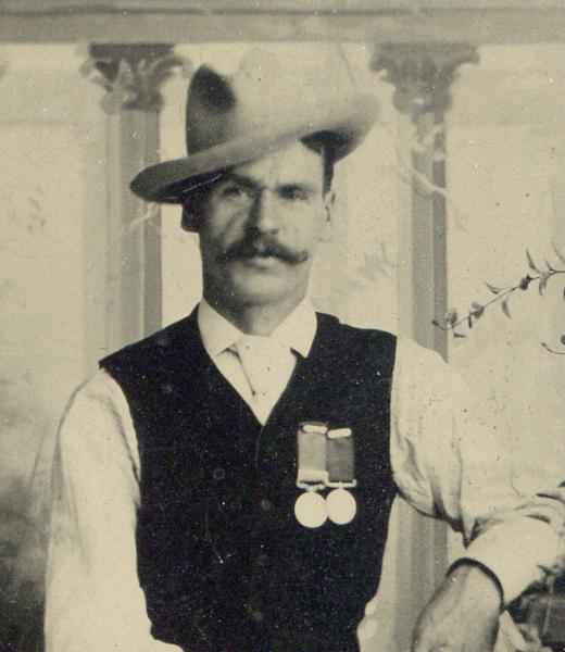 An old photo of a man with scars wearing a hat.